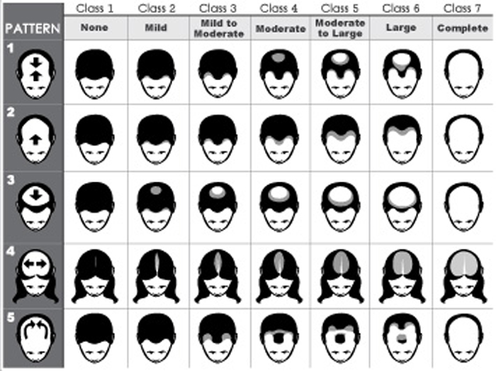 hair-loss-chat